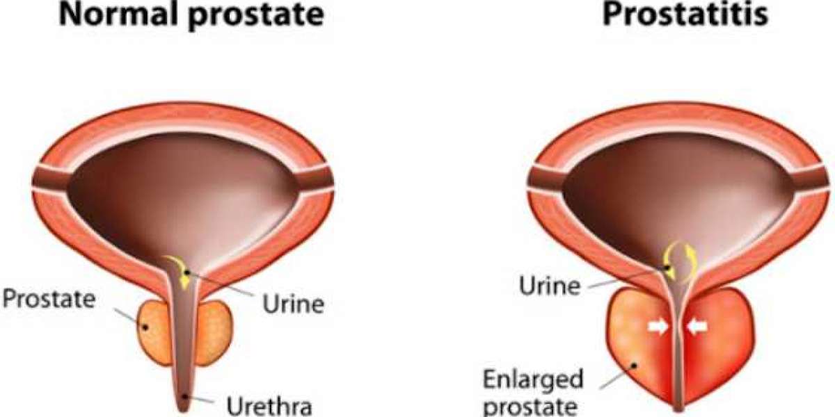 Gorilla Flow Reviews By My Personal Experience!