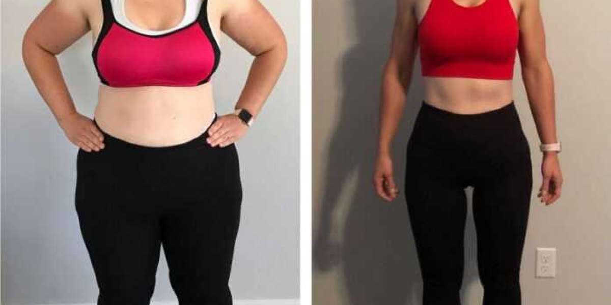 Apple Keto Gummies Australia Review