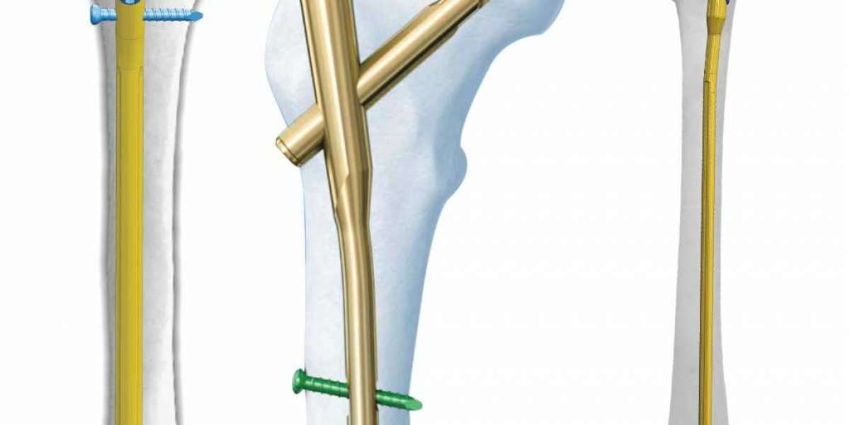 Best Orthopedic Supply Companies