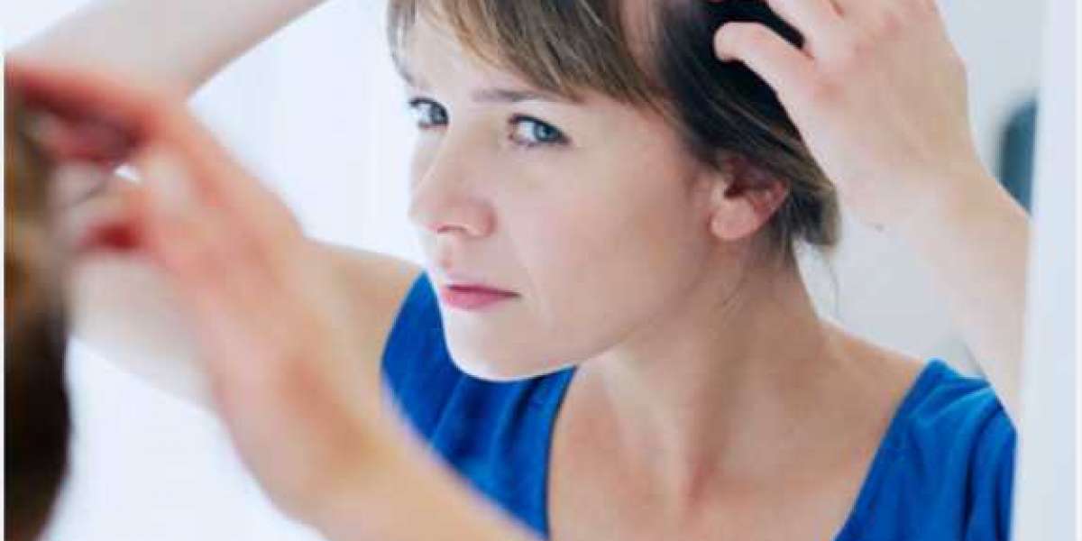 Alopecia areata treatment and Hair loss treatment