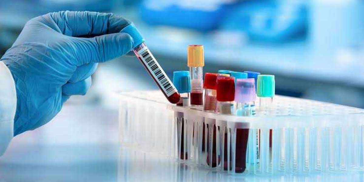 Tips to Consider When Choosing Medical Equipment Supplier in Dubai