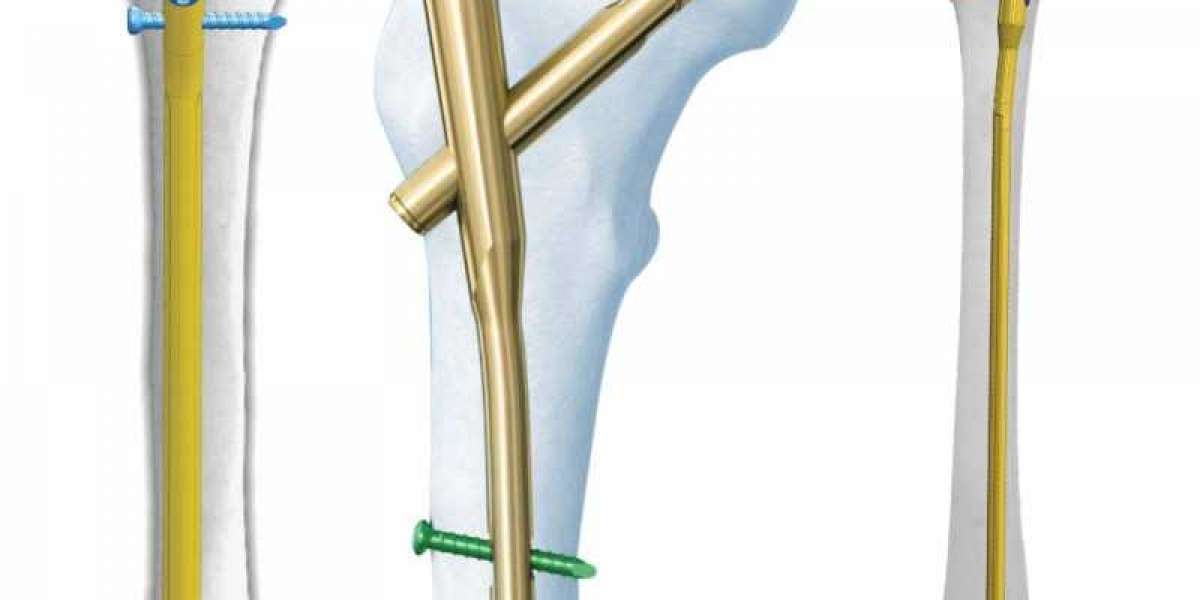 A Reliable Orthopedic Implants Company