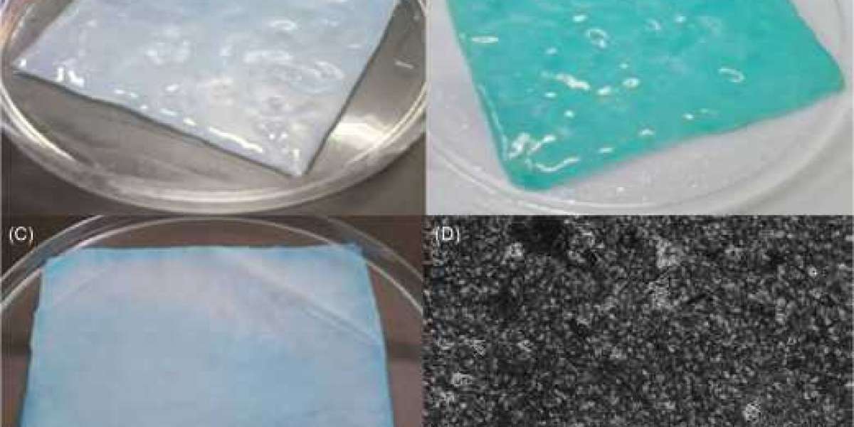 Bacterial Cellulose Market Current Trends, Opportunities and Growth Challenges by 2026