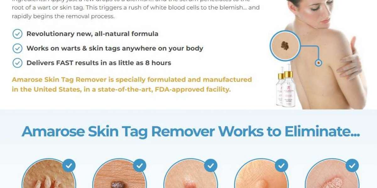 This Is Why This Year Will Be The Year Of Amarose Skin Tag Remover Reviews!