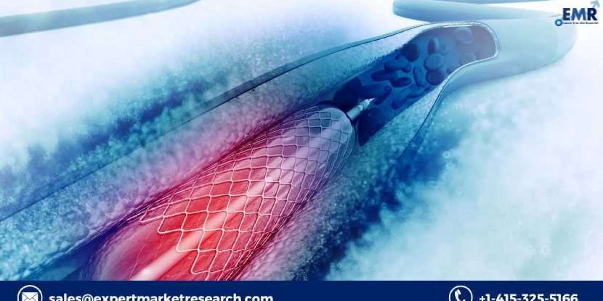 Global Cardiovascular Stents Market Size, Share, Key, Players, Demand, Growth, Analysis, Research, Report