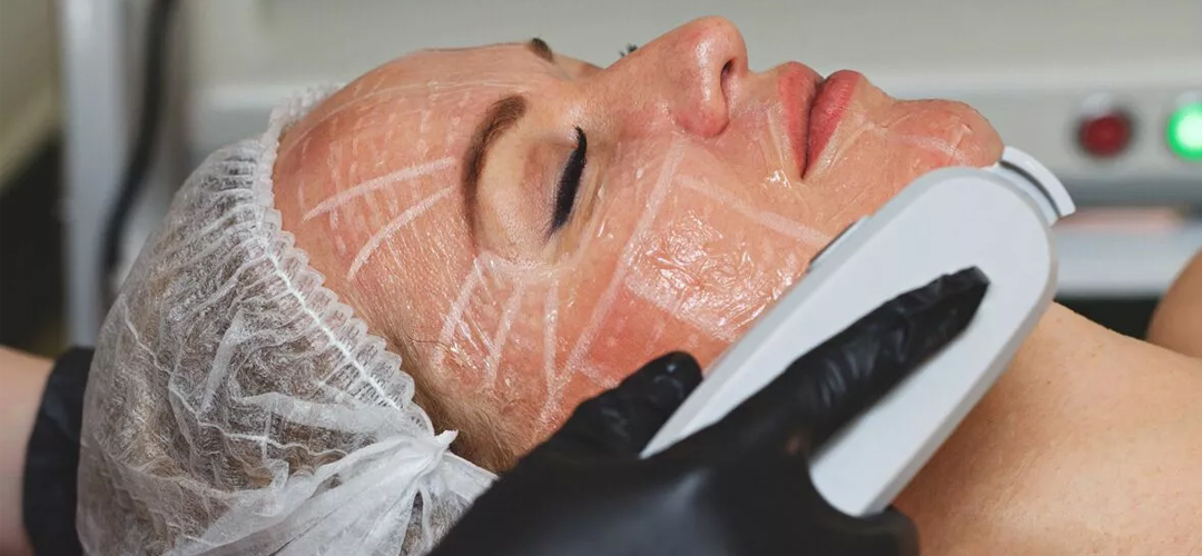 Non-Surgical Facelift London | HIFU Facelift Treatment