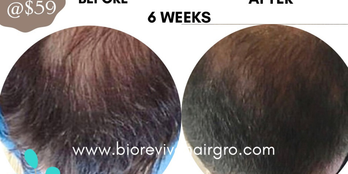Top 10 Benefits of BioReviveHairGro: Unlock Your Hair's Potential
