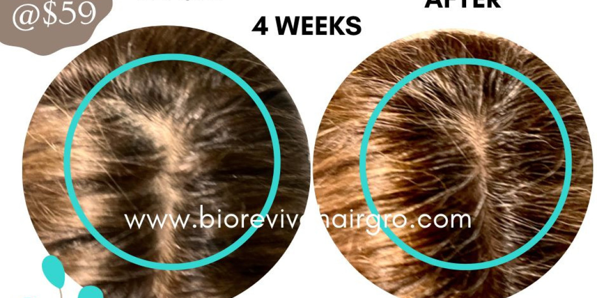 Transform Your Hair with BioReviveHairGro: The Top 10 Benefits