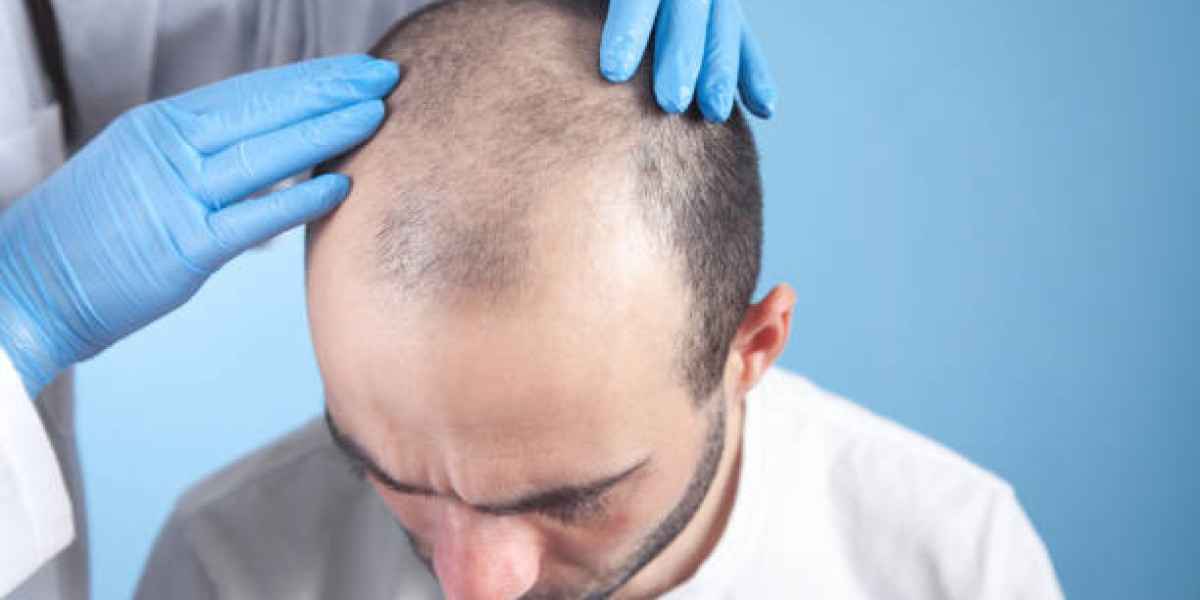 Post-Procedure Care: Essential Tips After Your Hair Transplant in Riyadh