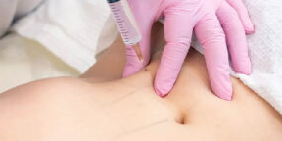 Pain Management During Fat Melting Injections: What to Expect