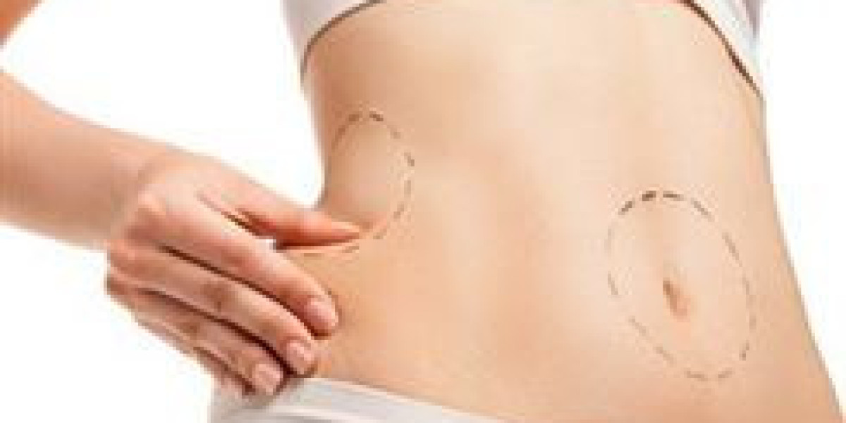 How to Prepare for Pain After Liposuction in Dubai