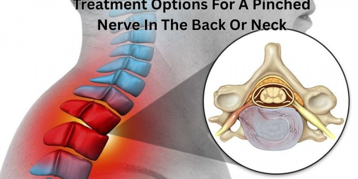 Treatment Options For A Pinched Nerve In The Back Or Neck