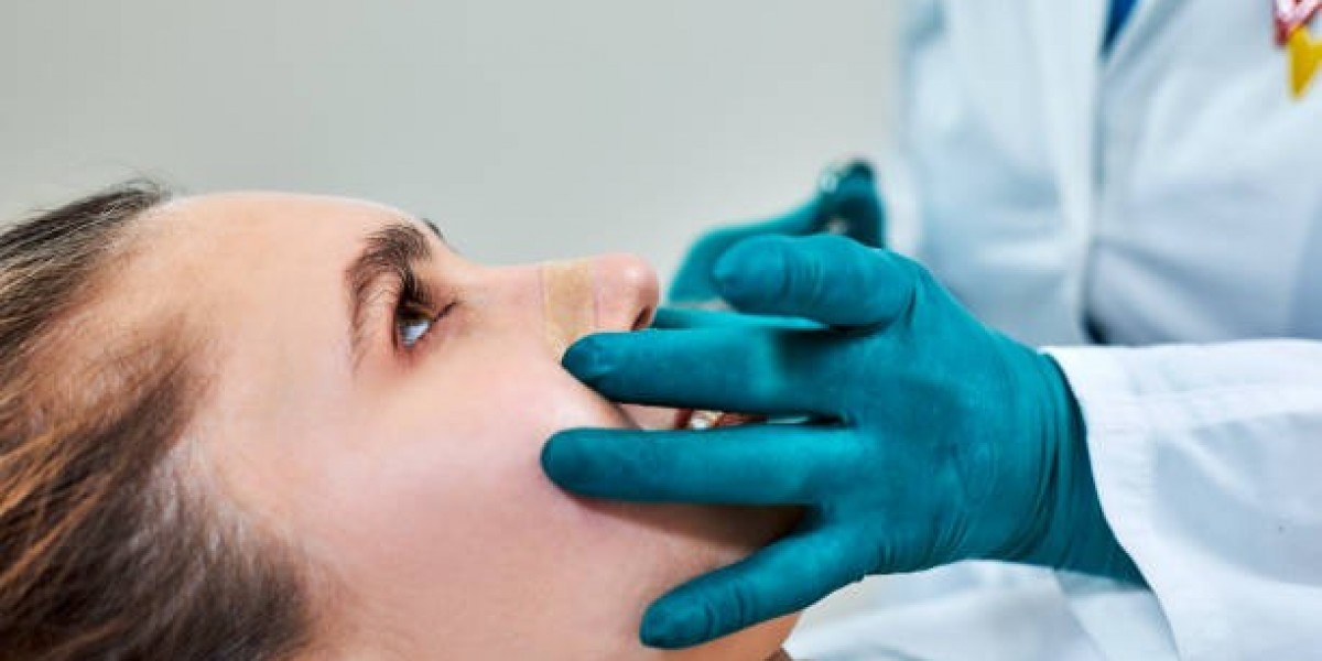 Sculpting Perfection: How Riyadh Surgeons Achieve Flawless Rhinoplasty Results