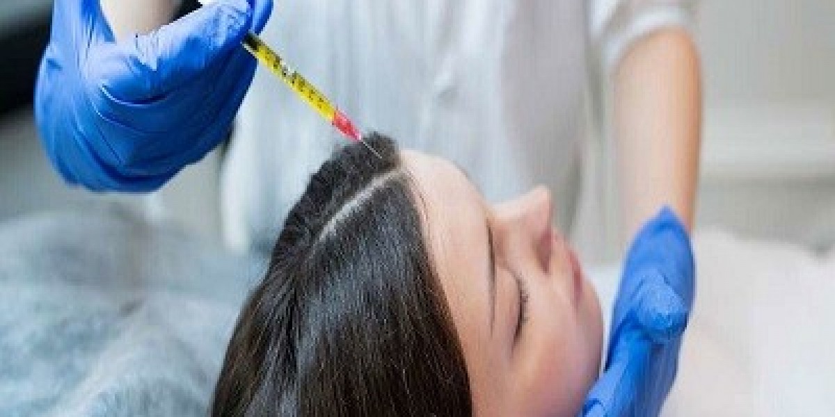 PRP vs. Hair Transplant: Which Is Better?