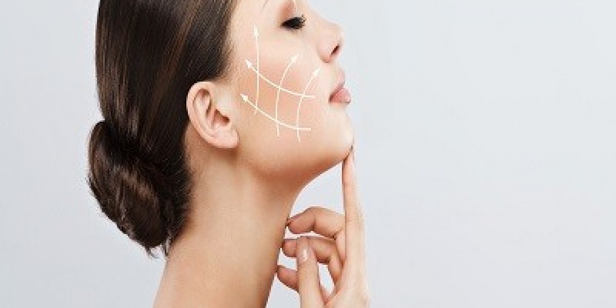 Is a facelift the right option for me?