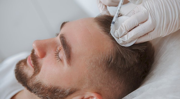 PRP Hair Treatment – A Revolutionary Solution for Hair Loss - Free Instant Approval Guest Posting Website