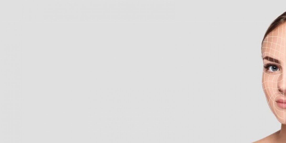 What are the Benefits of Thread Lifts?