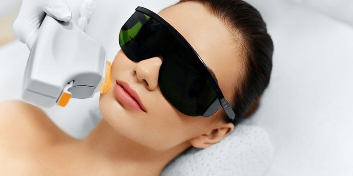 Can Laser Skin Tightening Improve the Appearance of Acne Scars?