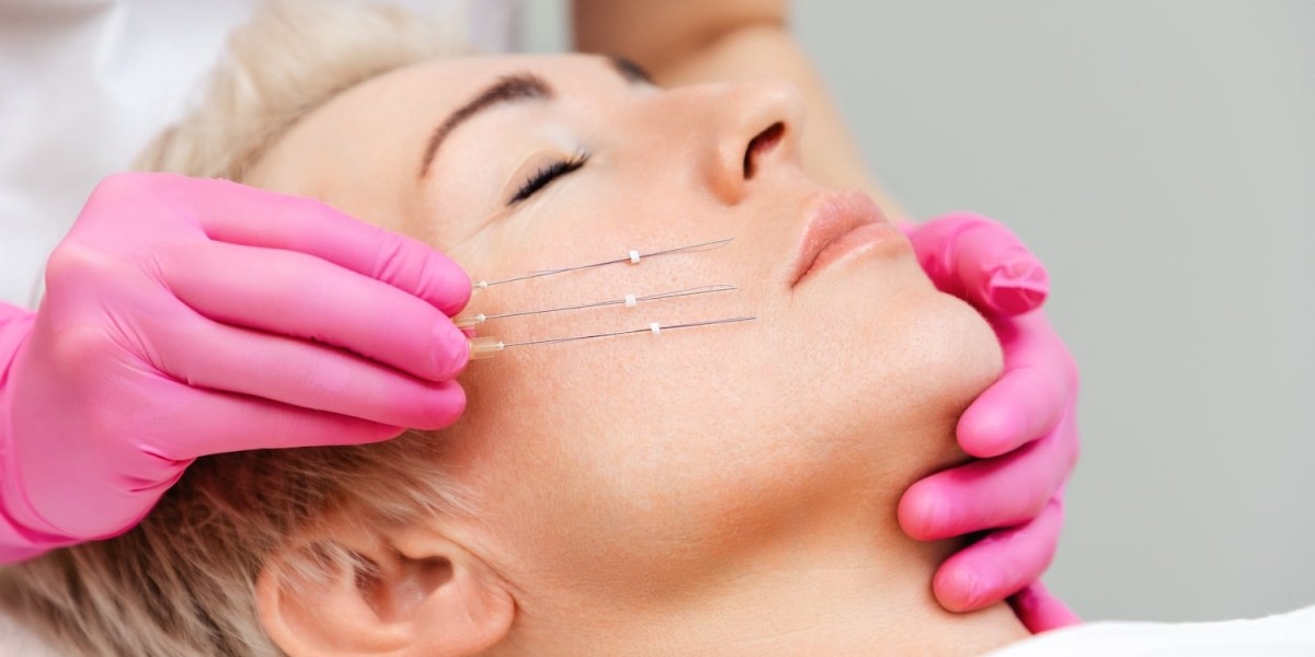 The History and Evolution of Thread Lift Treatments
