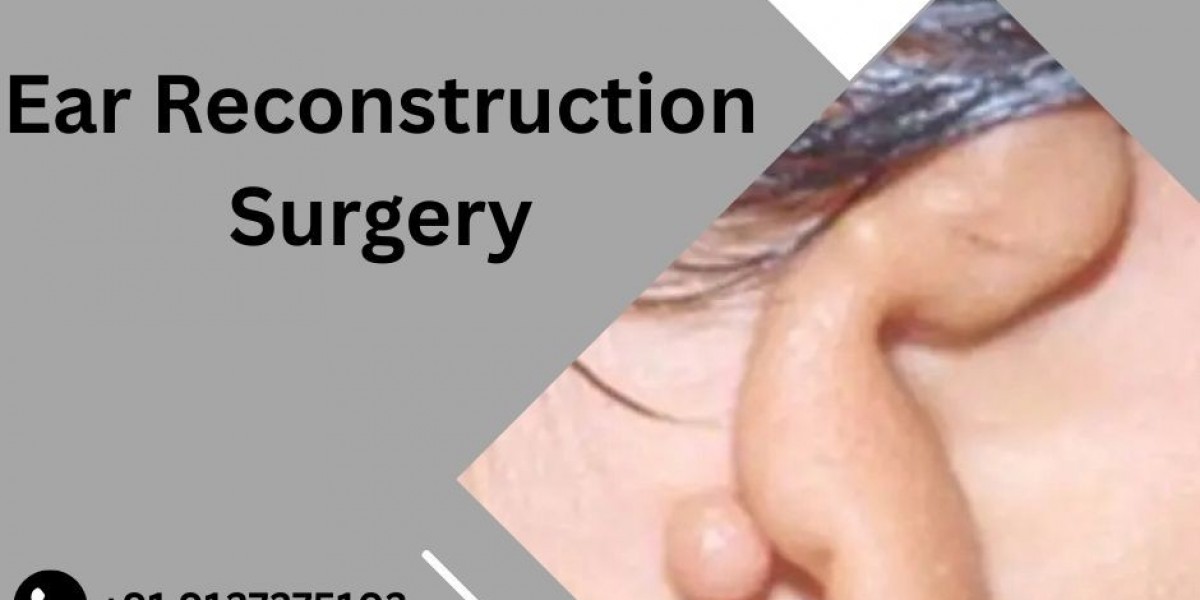 Why is Microtia Reconstruction Surgery Performed Using Rib Cartilage?