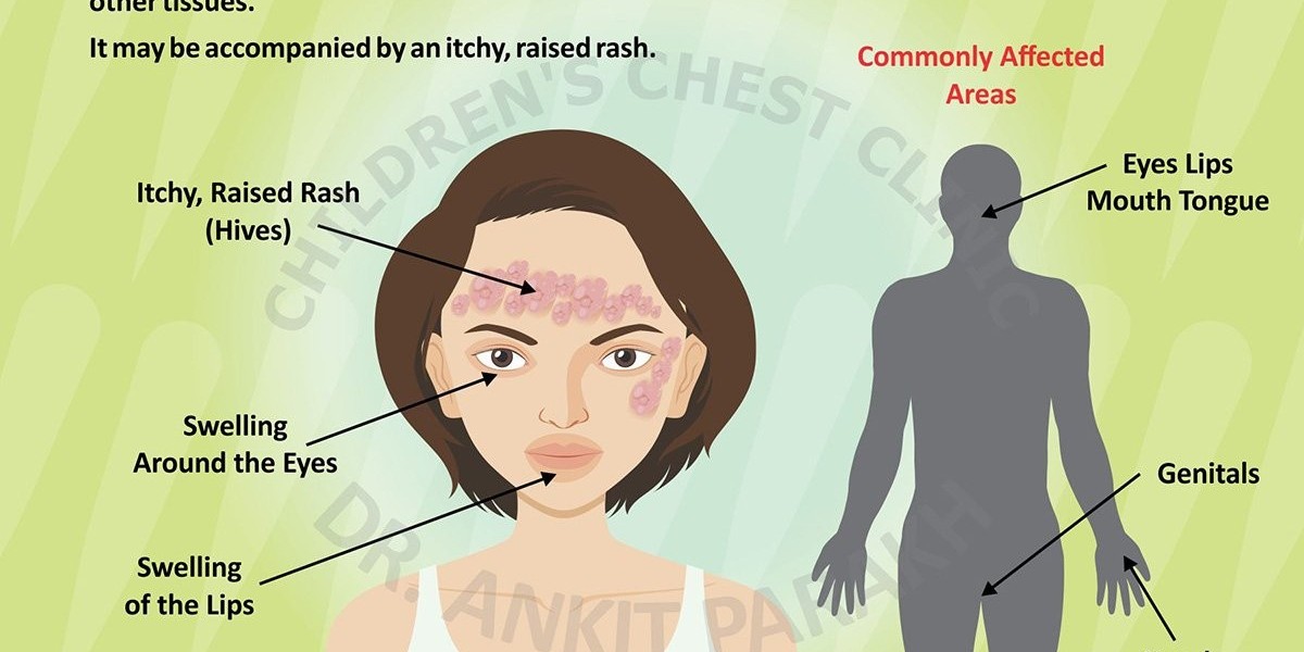 The Impact of Deeper Skin Layer Swelling on Health