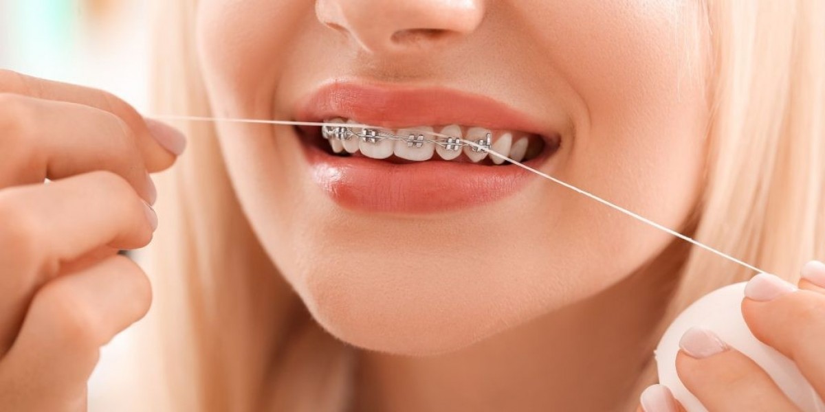 Why Clean Teeth Are the Real Secret to a Confident Smile