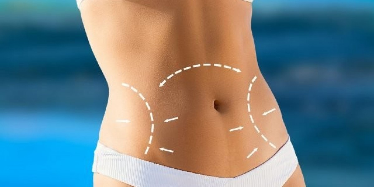 Everything You Need to Know About Tummy Tuck in Islamabad