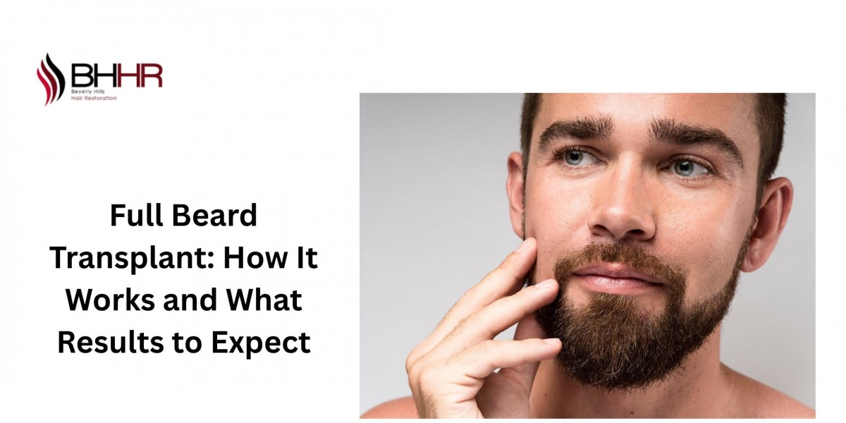 Full Beard Transplant: How It Works and What Results to Expect