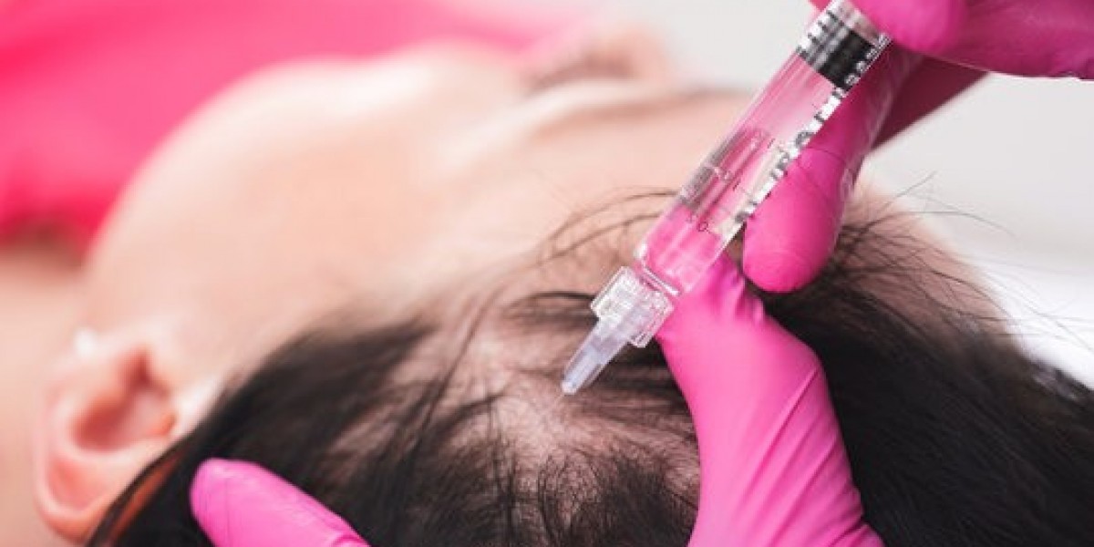 Why Some Patients See Faster Results from PRP Hair Treatment in Islamabad