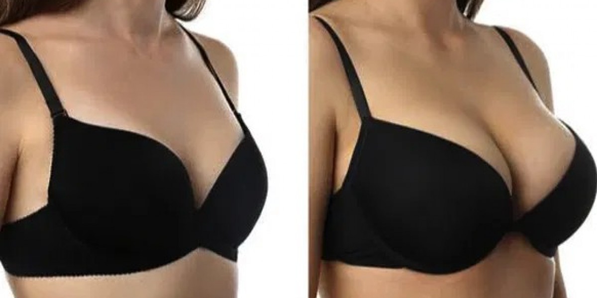 Breast Enlargement In Bangalore