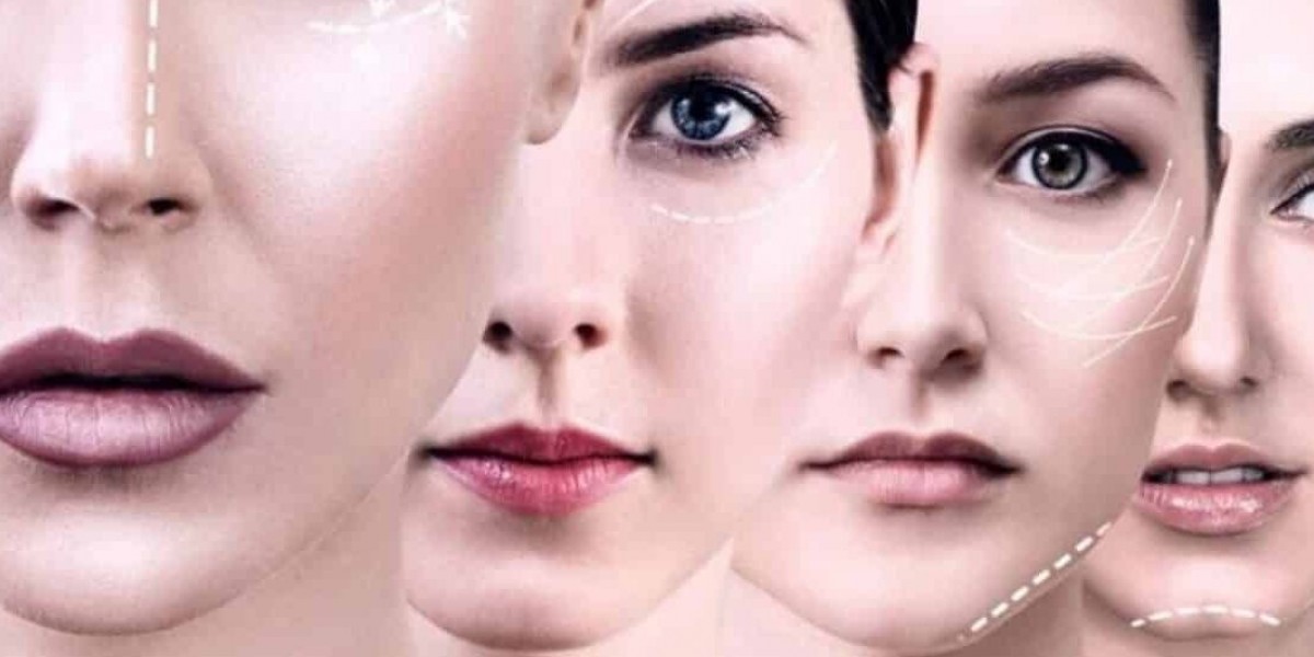 Renew Facial Firmness and Tone with Facelift Surgery