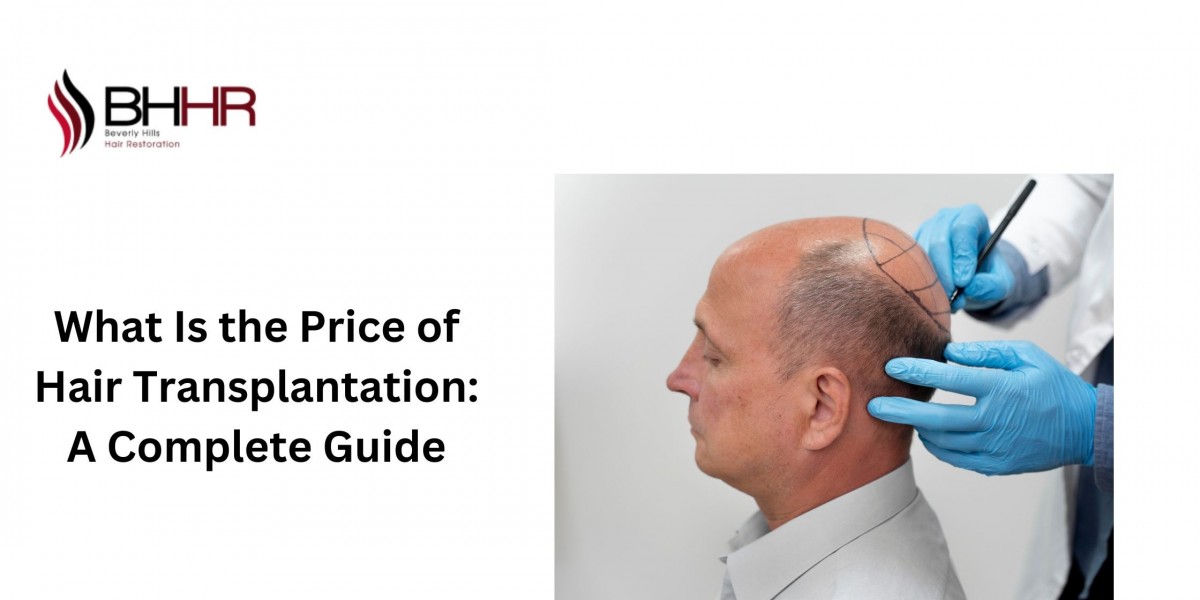 What Is the Price of Hair Transplantation: A Complete Guide