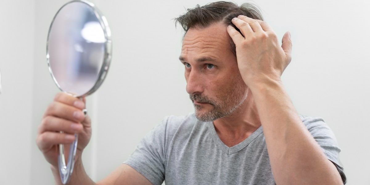 Does testosterone cause hair loss