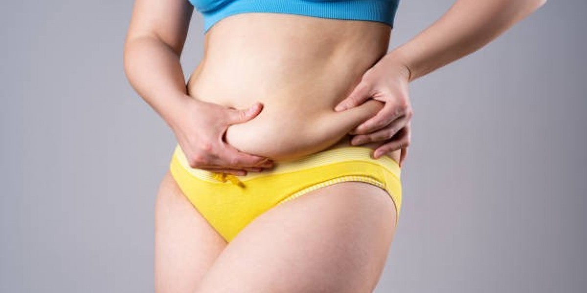 Liposuction in Riyadh Success Stories: Before, After, and Beyond