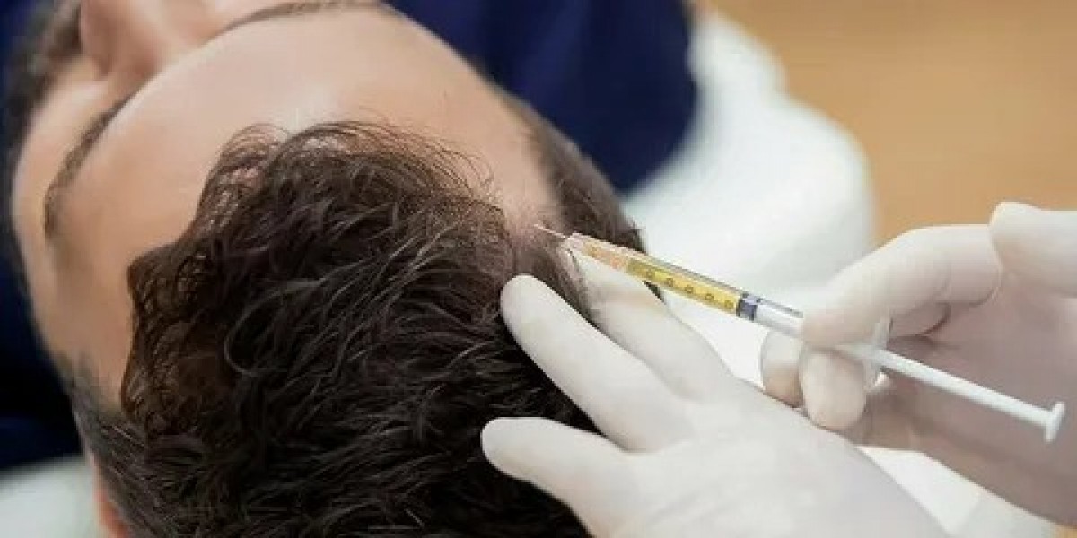 Best Hair Loss Treatments in Islamabad