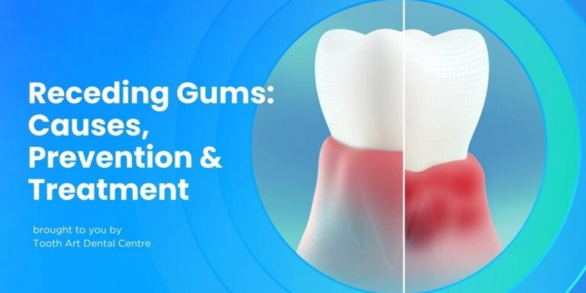 Choosing the Right Option for a Brighter Smile: Whitening vs Veneers