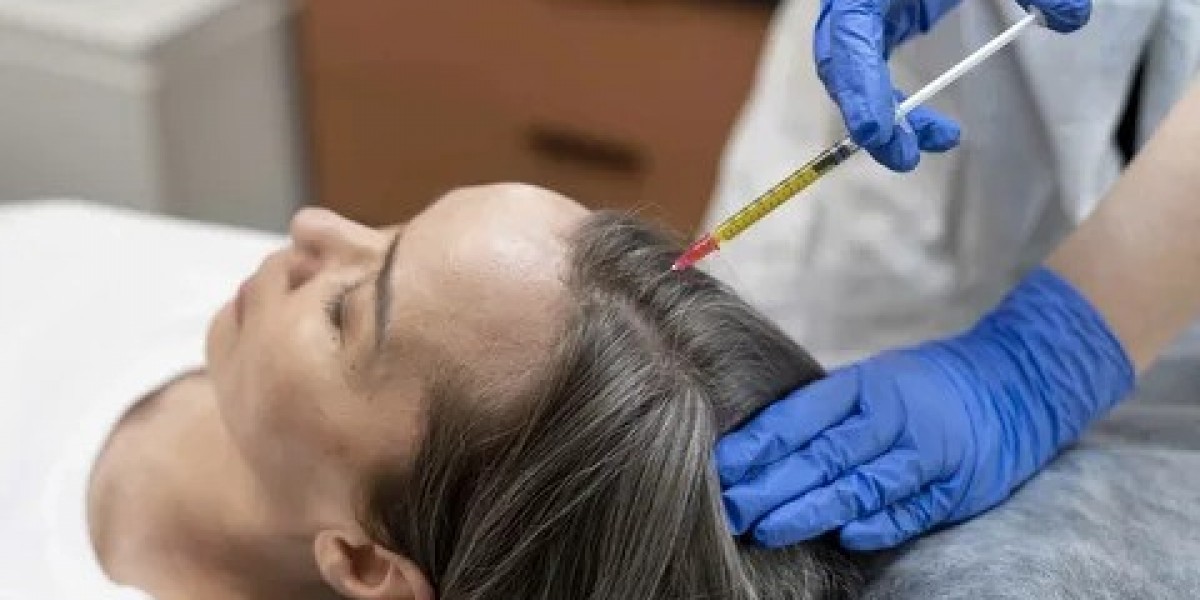 Best Hair Loss Treatments in Islamabad