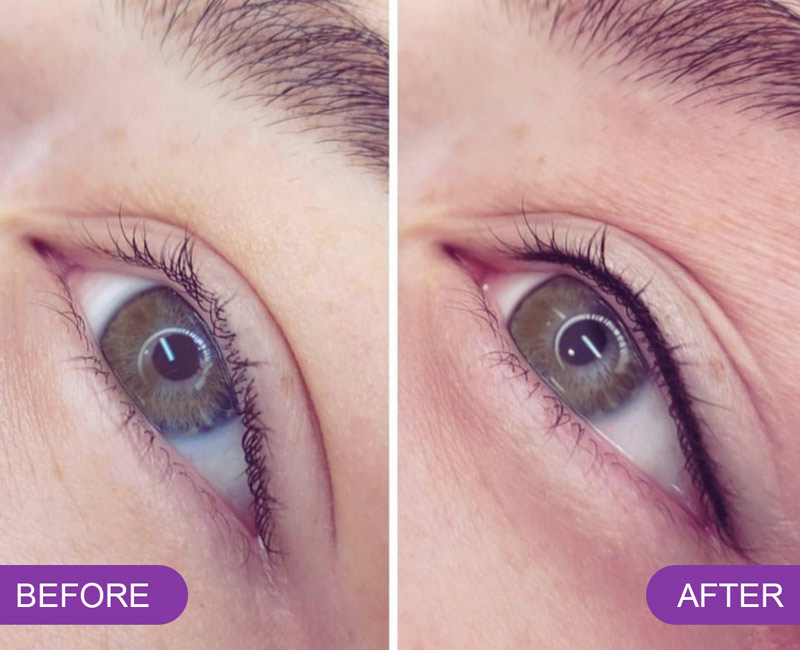 Eyelash Extensions in Kolkata | Price & Types Explained | Truly Permanent Beauty