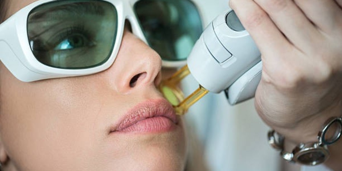 Common Myths and Misconceptions About Laser Hair Removal Debunked