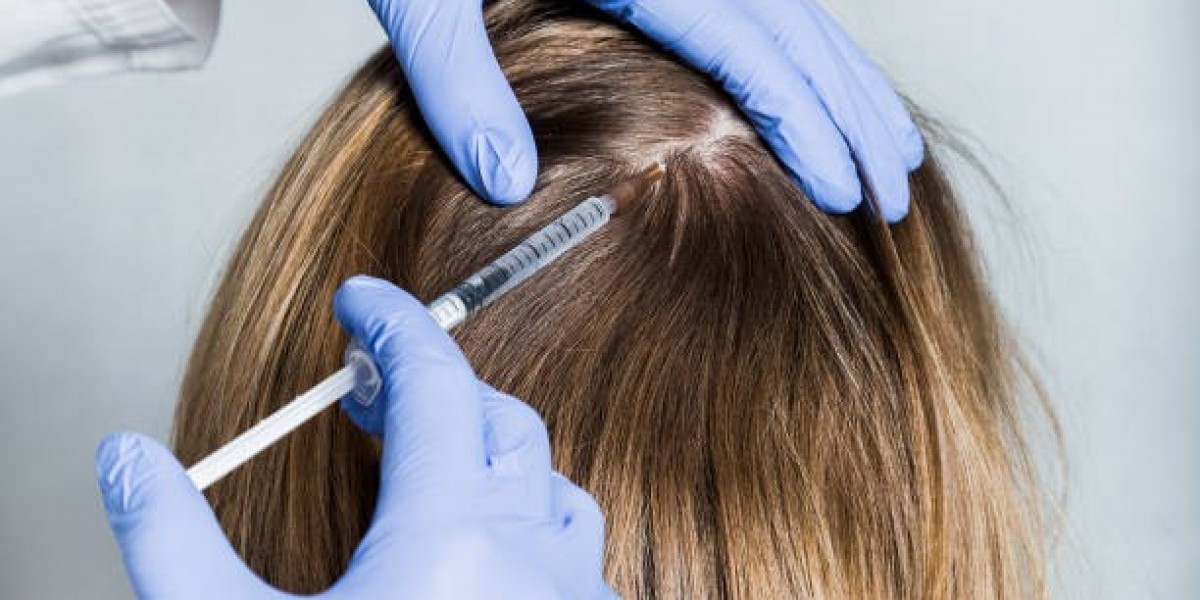 Can PRP Hair Treatment Help Combat Genetic Hair Loss?