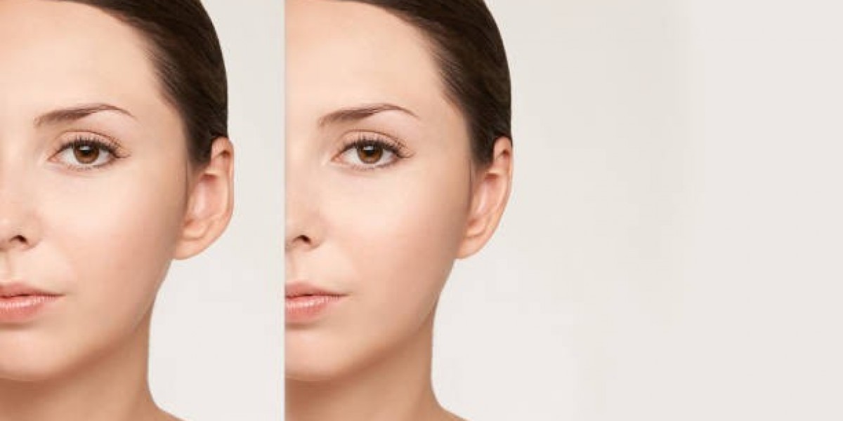 جراحة تجميل الأذن في الرياض: تعرف على أحدث الابتكارات