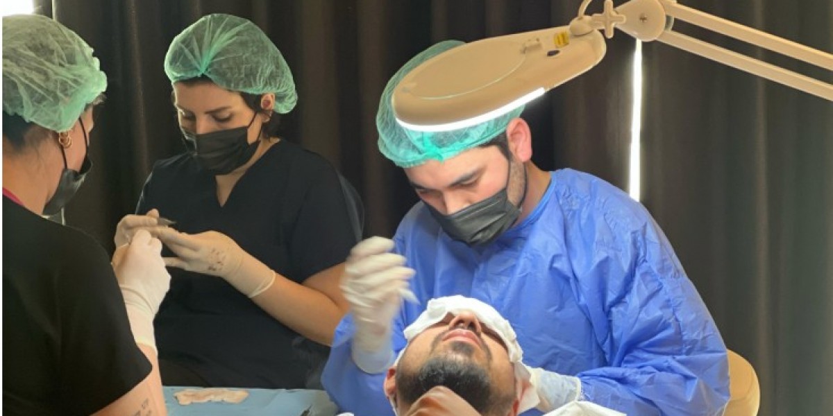 DHI Method: The Future of Natural Hair Restoration