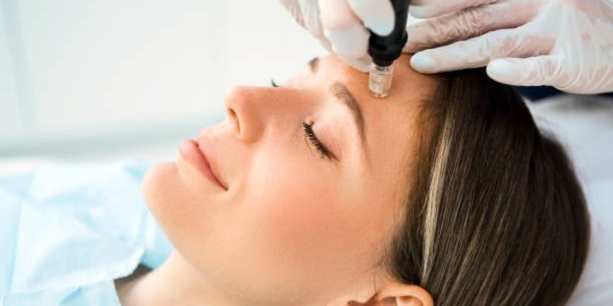 Facelift Surgery Recovery Tips for Smooth and Effective Healing