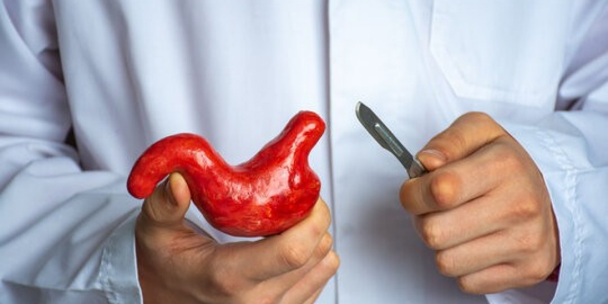 Best Bariatric Surgeon in Islamabad – A Path to Lasting Weight Loss