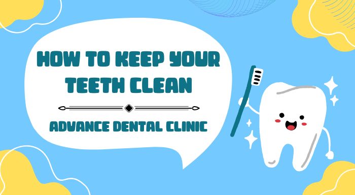 How to Keep Your Teeth Clean - Advance Dental Clinic