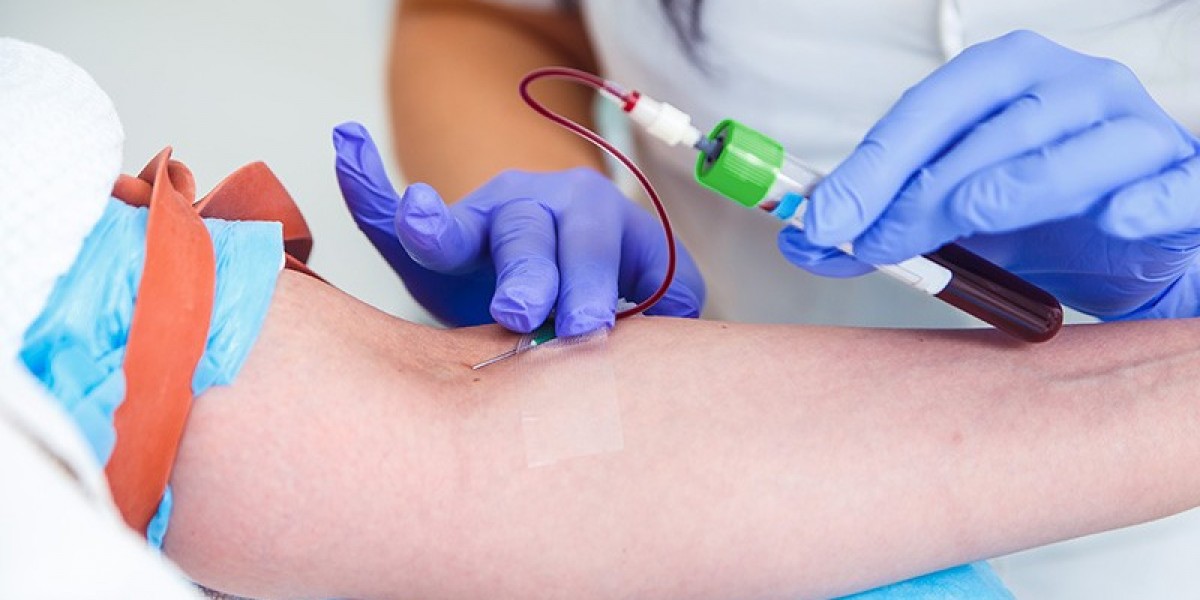 Lab Test at Home Dubai – Modern Healthcare at Your Doorstep