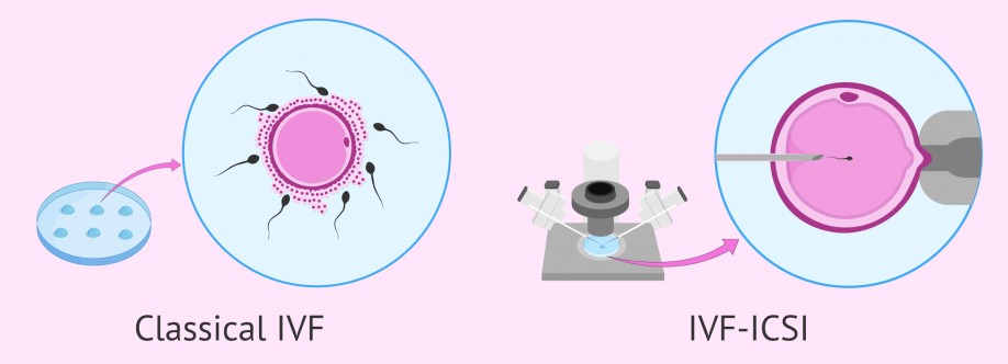 Ritu Agarwal Cover Image