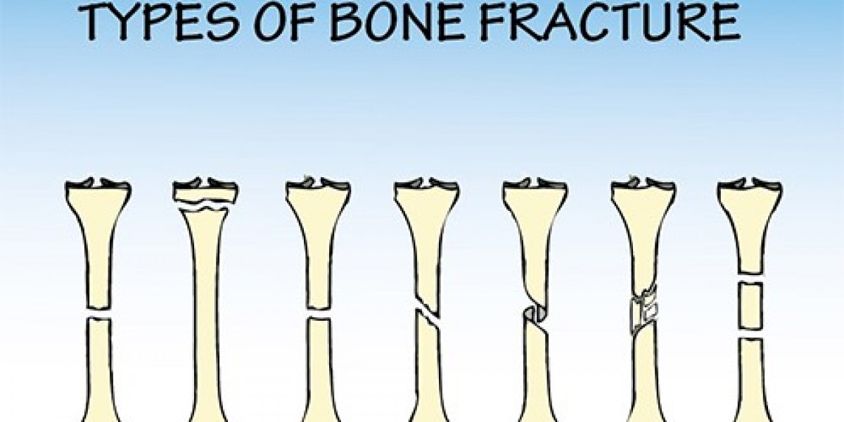 Precautions After Bone Fracture Surgery