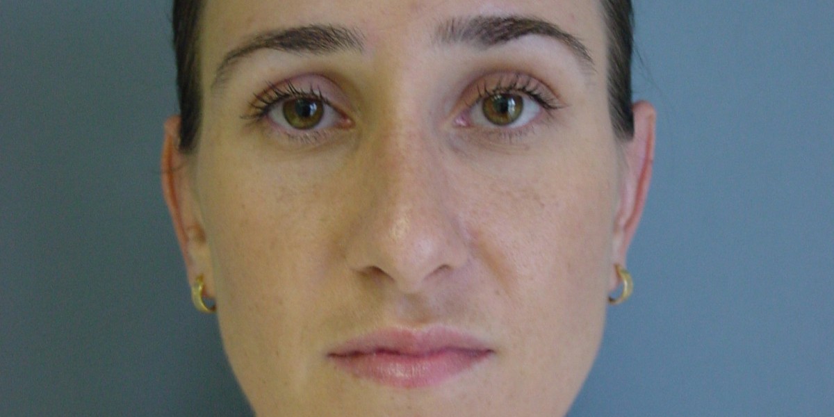 Dr  Miguel Gómez Bravo , Specialist Plastic Surgeon