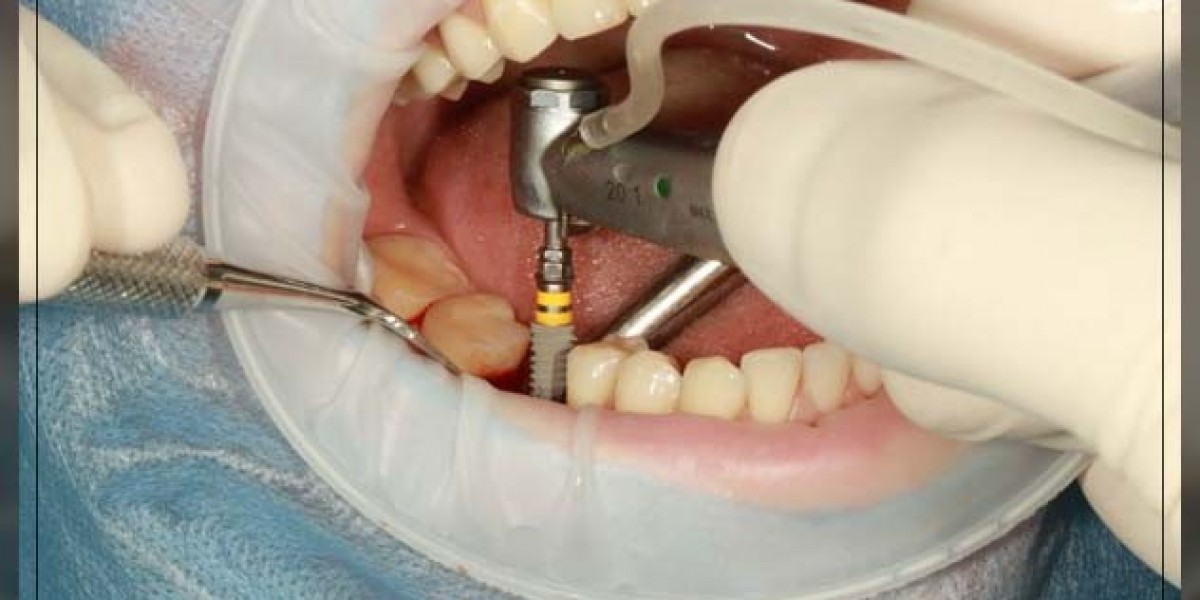 Comprehensive Maxillofacial Care with Skilled Surgeons in Dubai